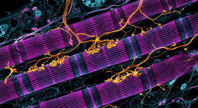 Confocal fluorescence microscopy visualization of skeletal muscle fibers and neuromuscular cellular structures