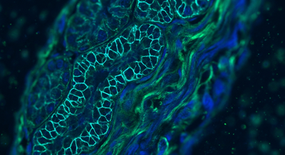 Fluorescence microscopy-style visualization of claudin-1 protein channels in kidney tissue as an anti-fibrotic antibody acts on fibrosis