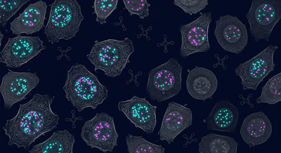 Fluorescence microscopy view of a single transfer RNA signal marking androgen-dependent prostate cancer cells