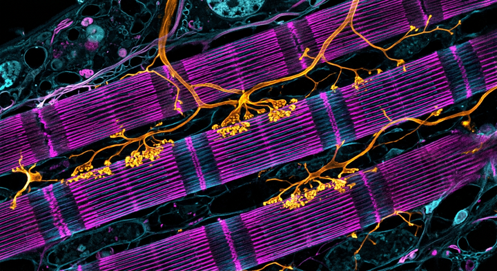 Confocal fluorescence microscopy visualization of skeletal muscle fibers and neuromuscular cellular structures