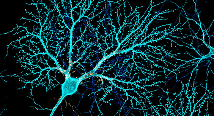 Confocal fluorescence microscopy of cerebellar neural networks and dendritic arborization