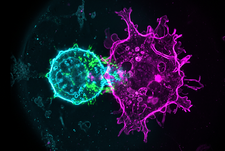 Fluorescence microscopy of an immune T-cell recognizing a melanoma cancer cell, representing a personalized cancer vaccine training the immune system